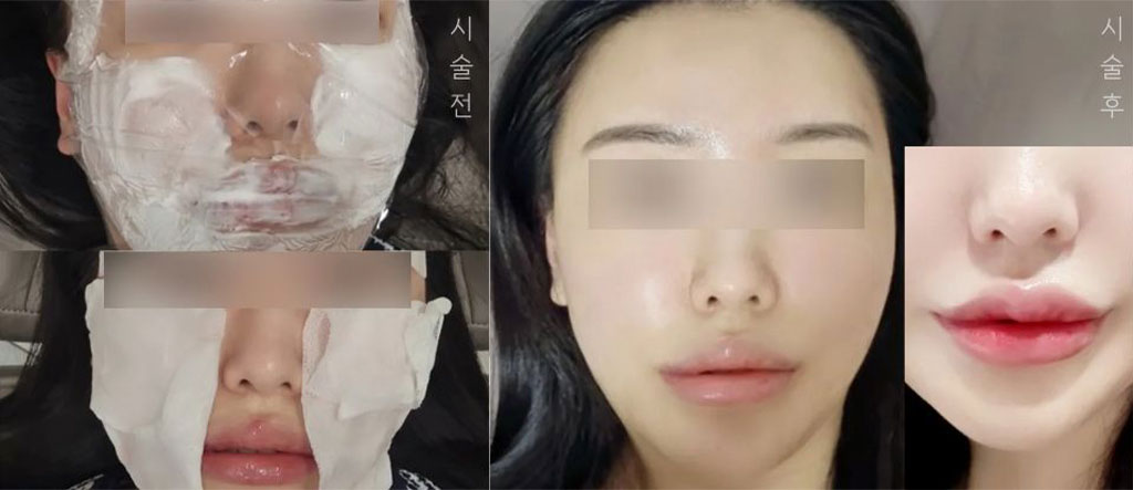 Before & After